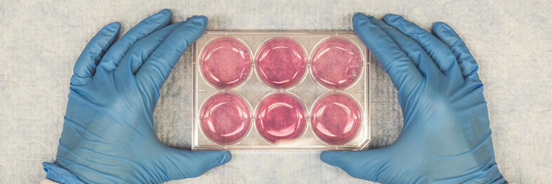 What functional labs can reveal that standard bloodwork misses