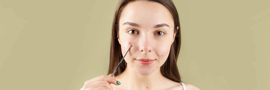 Why Your Skin Purges Before It Clears