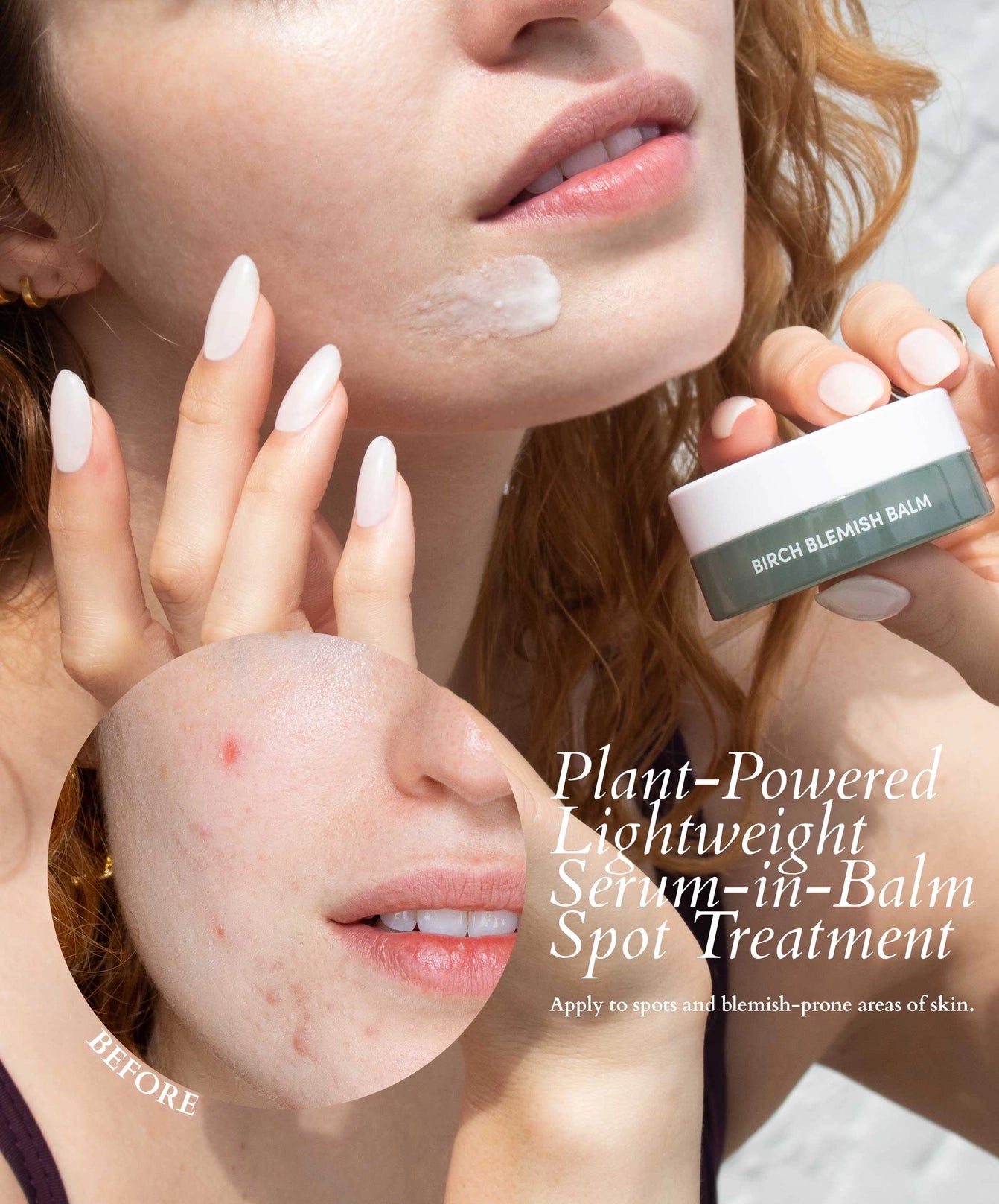 Birch Blemish Balm